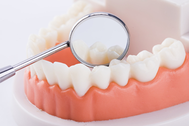 牙痛到尖叫！！其实你还有一条路，做根管治疗吧~~